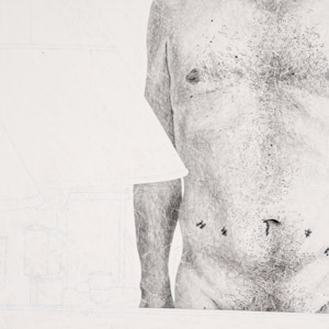 Artistic hand drawing by Herbert Stattler of a patient’s reflection in a hospital room mirror. The image shows a bare male torso nine weeks post-prostatectomy with visible healing scars, framed by the partial view of a bedside reading lamp.